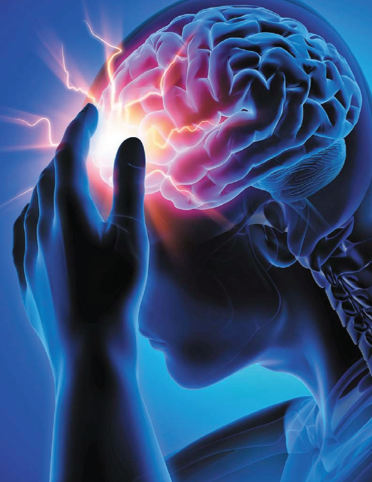 Headaches-Vsm